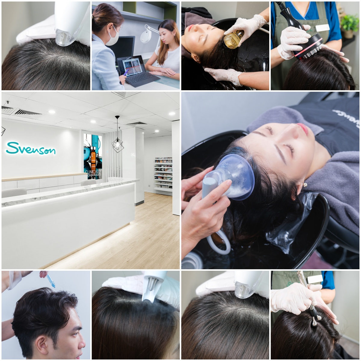 发理学科研专家「史云逊Svenson」 现引入崭新精密冷冻科技　针对改善炎夏发肌问题 助爱美之士摆脱头油及脱发危机
